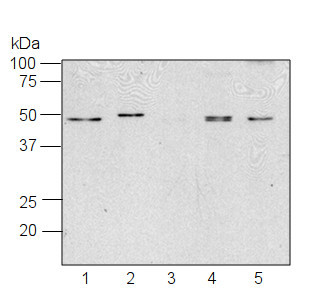 western blot using anti-RPS1 antibodies